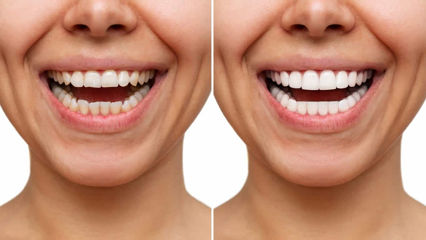 This Popular Mineral Is Reshaping The Dental Industry